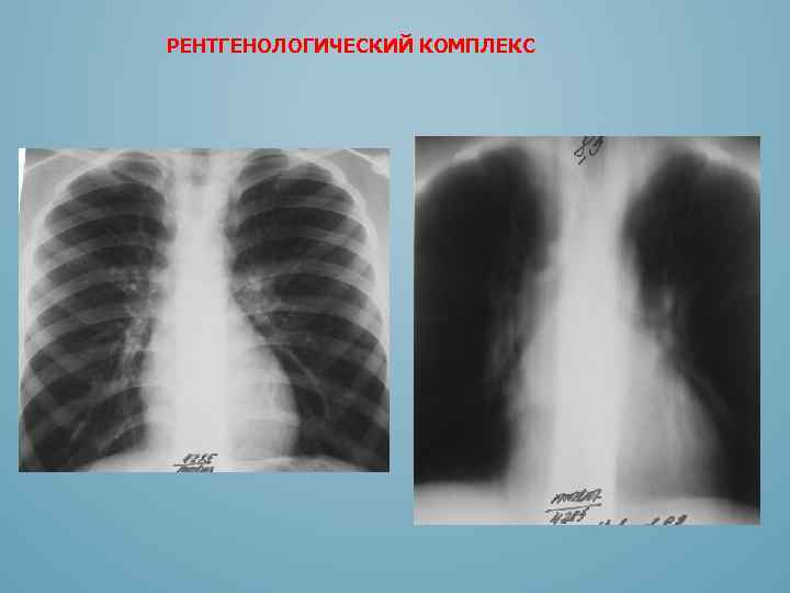 РЕНТГЕНОЛОГИЧЕСКИЙ КОМПЛЕКС 