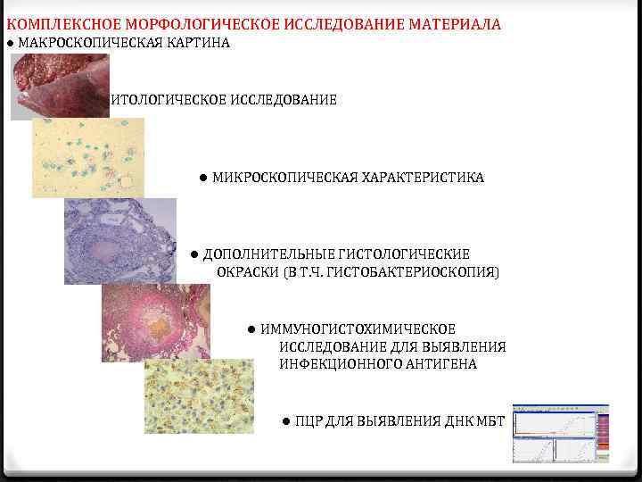 Микроскопические параметры. Морфологическое и гистологическое исследование. Морфологическое исследование и гистологическое исследование. Морфологическое иммуногистохимическое исследование. Материал для морфологического исследования.