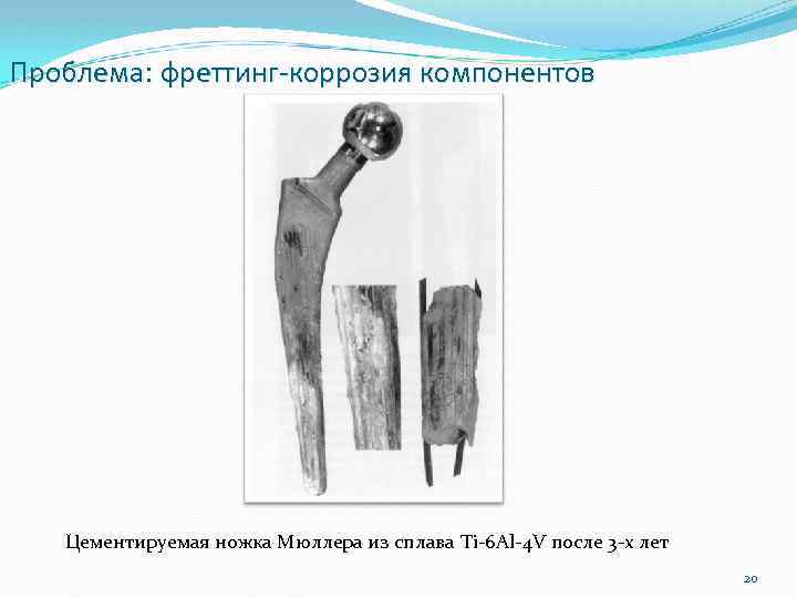 Проблема: фреттинг-коррозия компонентов Цементируемая ножка Мюллера из сплава Ti-6 Al-4 V после 3 -х