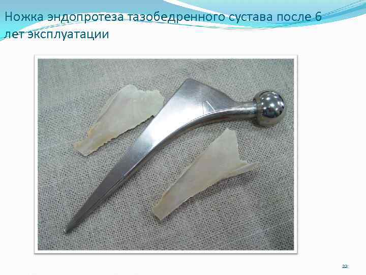 Ножка эндопротеза тазобедренного сустава после 6 лет эксплуатации 22 