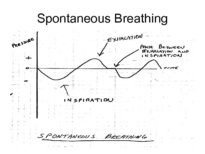 Spontaneous Breathing 