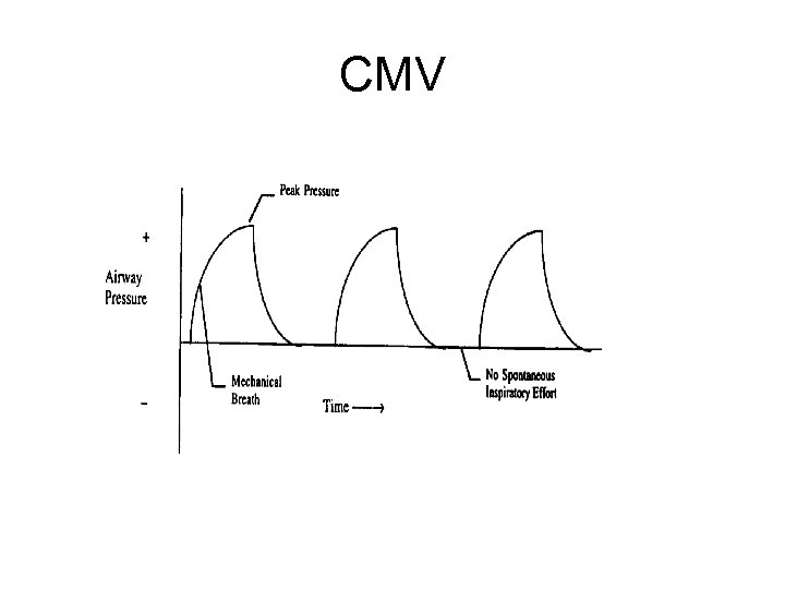 CMV 