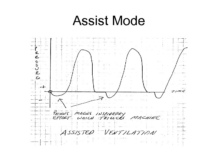 Assist Mode 
