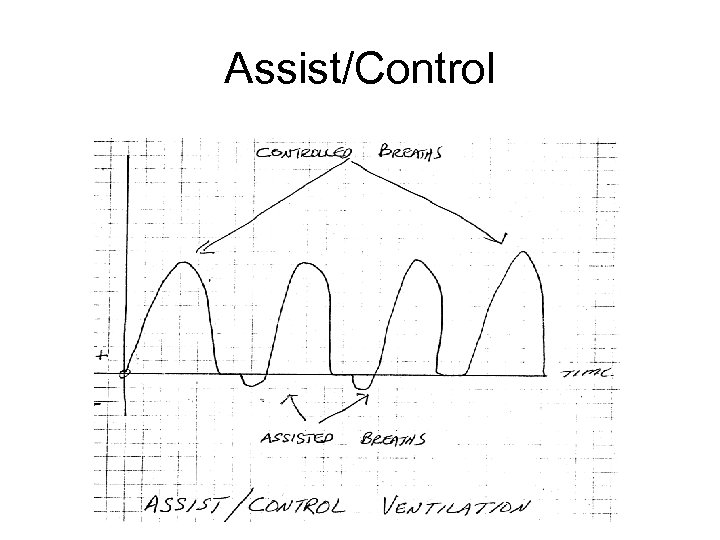 Assist/Control 