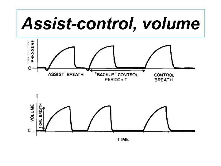 Assist-control, volume 