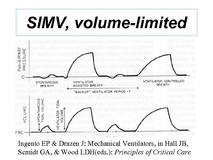 SIMV, volume-limited Ingento EP & Drazen J: Mechanical Ventilators, in Hall JB, Scmidt GA,