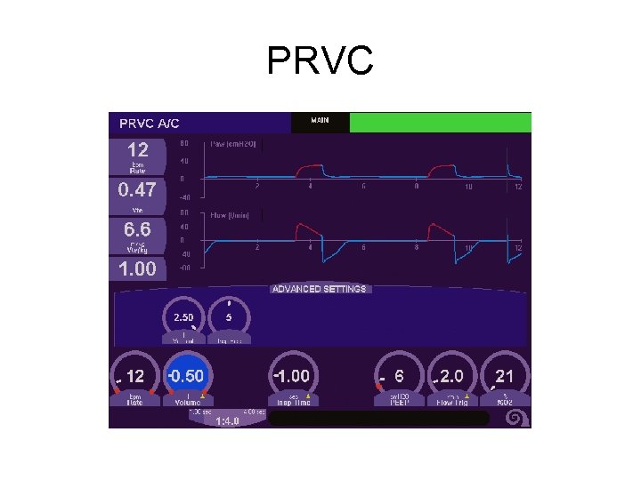 PRVC 