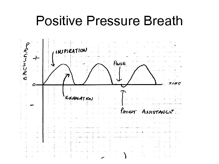 Positive Pressure Breath 