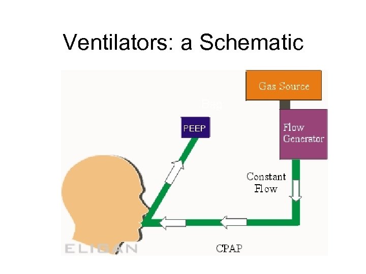 Ventilators: a Schematic 