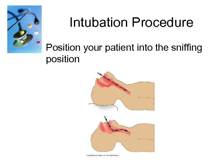 Intubation Procedure Position your patient into the sniffing position 