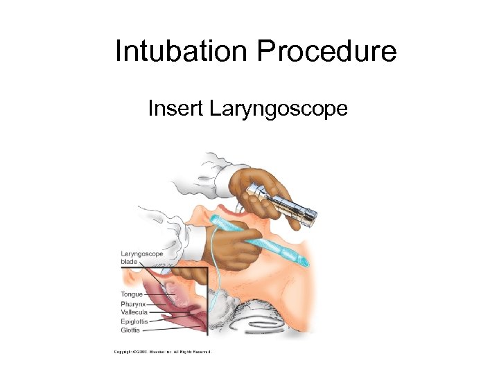 Intubation Procedure Insert Laryngoscope 