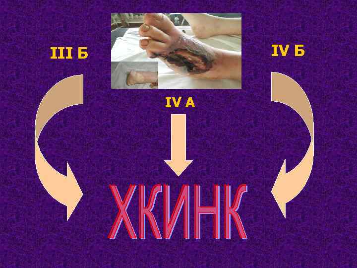 IV Б III Б IV A 