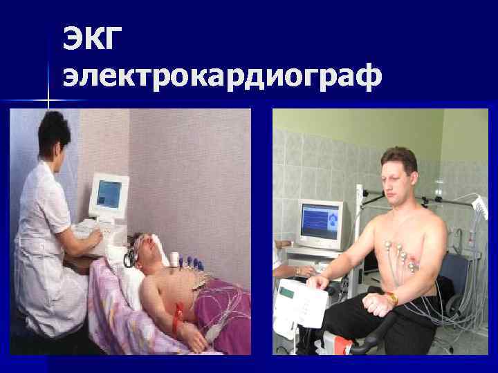 ЭКГ электрокардиограф 