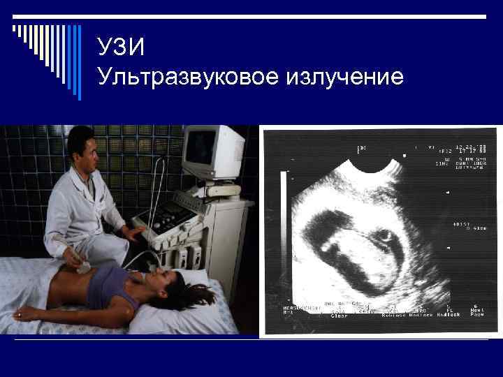 УЗИ Ультразвуковое излучение 
