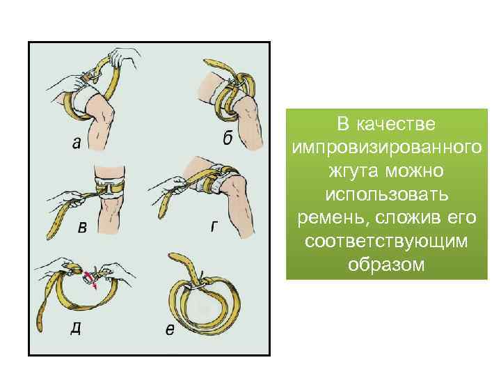 В качестве импровизированного жгута можно использовать ремень, сложив его соответствующим образом 