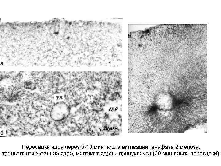 Пересадка ядра через 5 -10 мин после активации: анафаза 2 мейоза, трансплантированное ядро, контакт