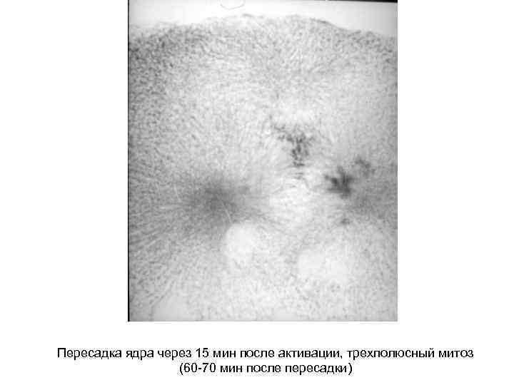 Пересадка ядра через 15 мин после активации, трехполюсный митоз (60 -70 мин после пересадки)