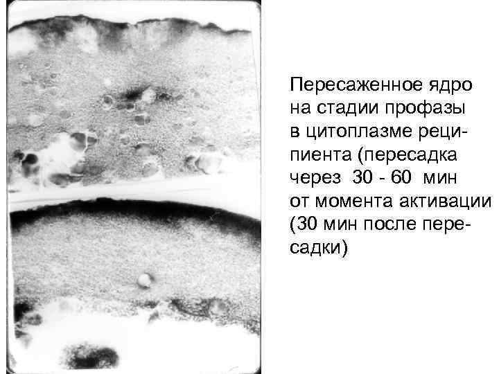 Пересаженное ядро на стадии профазы в цитоплазме реципиента (пересадка через 30 - 60 мин