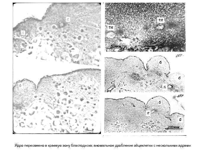 Ядро пересажено в краевую зону бластодиска; аномальное дробление яйцеклетки с несколькими ядрами 