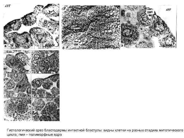 Гистологический срез бластодермы интактной бластулы: видны клетки на разных стадиях митотического цикла; пмя –