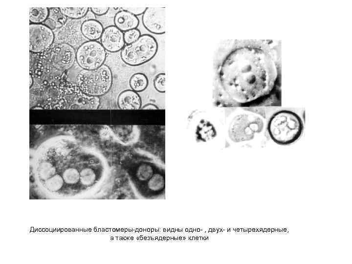Диссоциированные бластомеры-доноры: видны одно- , двух- и четырехядерные, а также «безъядерные» клетки 