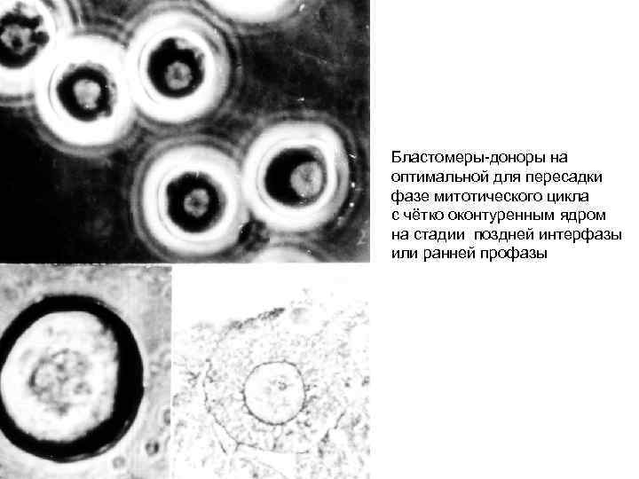 Бластомеры-доноры на оптимальной для пересадки фазе митотического цикла с чётко оконтуренным ядром на стадии