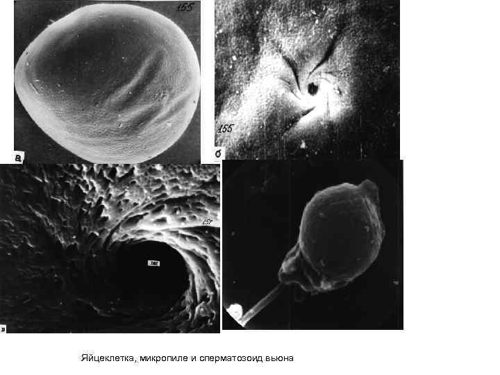 Яйцеклетка, микропиле и сперматозоид вьюна 