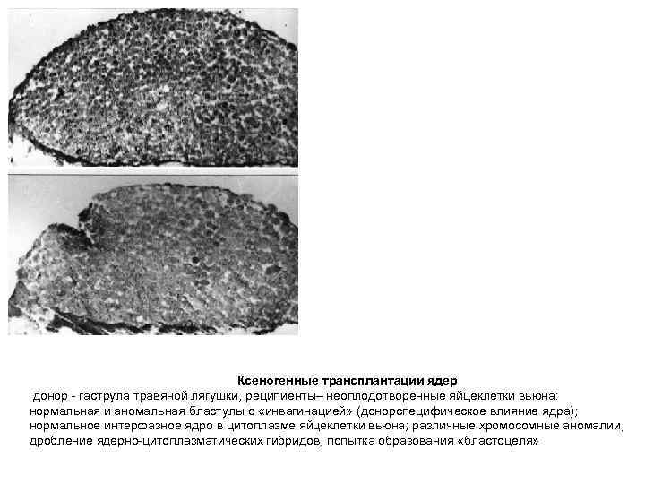 Ксеногенные трансплантации ядер донор - гаструла травяной лягушки, реципиенты– неоплодотворенные яйцеклетки вьюна: нормальная и