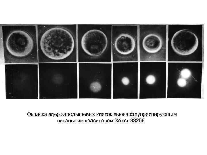 Окраска ядер зародышевых клеток вьюна флуоресцирующим витальным красителем Хёхст 33258 