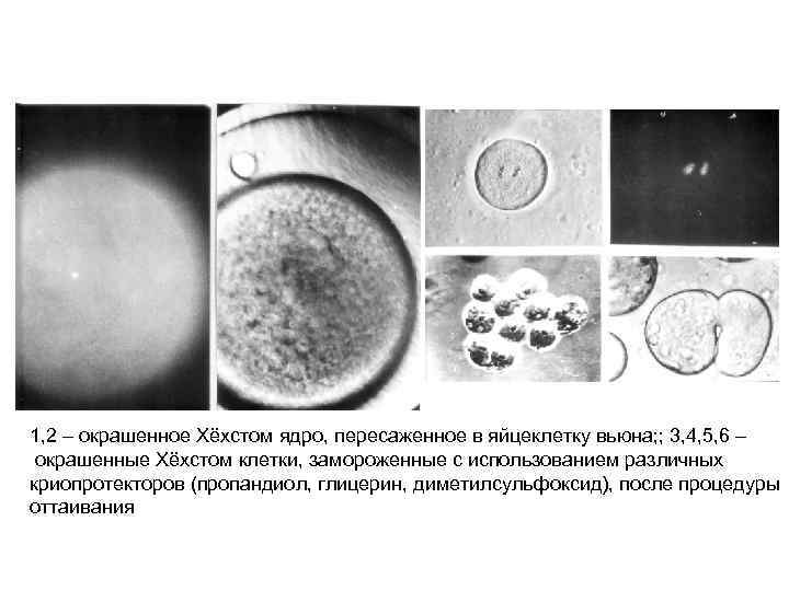 1, 2 – окрашенное Хёхстом ядро, пересаженное в яйцеклетку вьюна; ; 3, 4, 5,