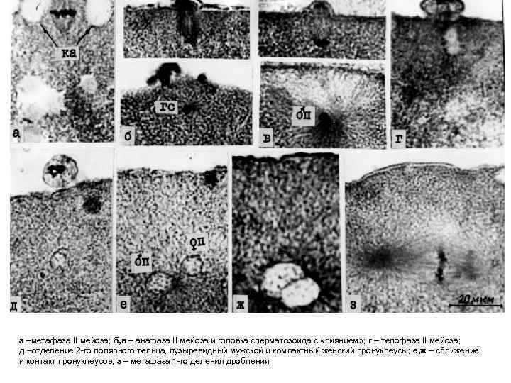 а –метафаза II мейоза; б, в – анафаза II мейоза и головка сперматозоида с