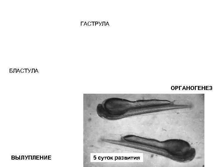 ГАСТРУЛА БЛАСТУЛА ОРГАНОГЕНЕЗ ВЫЛУПЛЕНИЕ 5 суток развития 