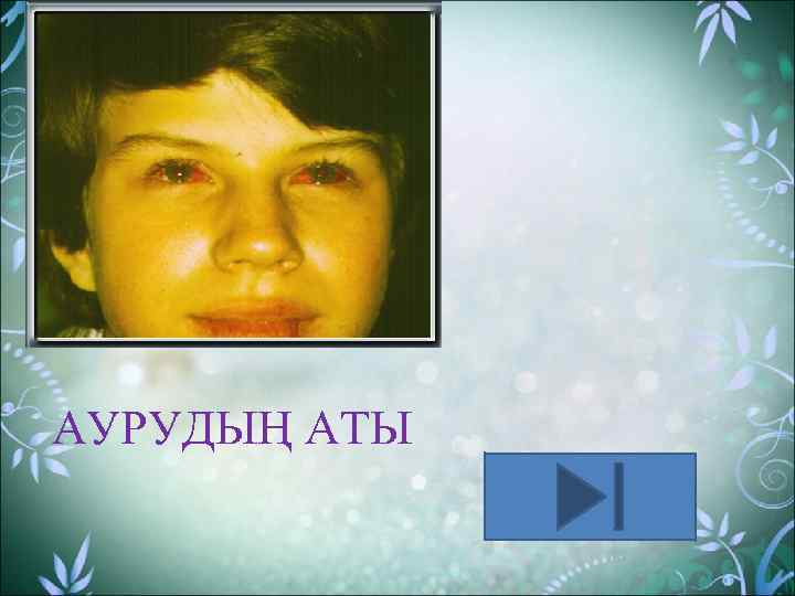 АУРУДЫҢ АТЫ 