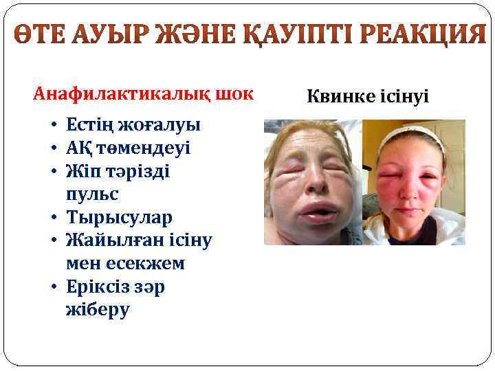 Анафилактикалық шок • Естің жоғалуы • АҚ төмендеуі • Жіп тәрізді пульс • Тырысулар