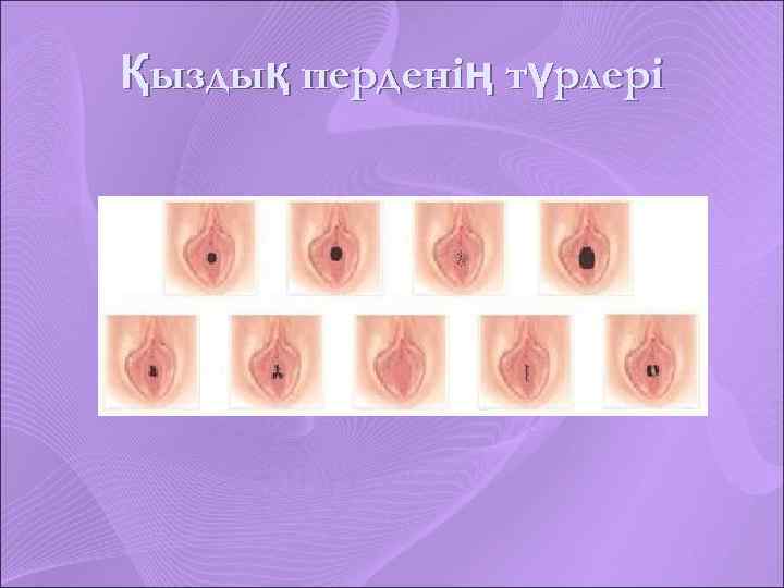 Қыздық перденің түрлері 