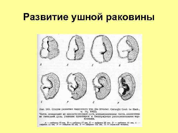 Зародыш ухо. Эмбриональное развитие наружного уха. Онтогенез наружного уха. Эмбриогенез органа слуха. Пороки развития ушной раковины.