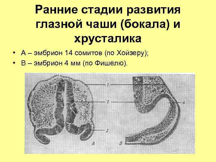 Ранние стадии развития глазной чаши (бокала) и хрусталика • А – эмбрион 14 сомитов