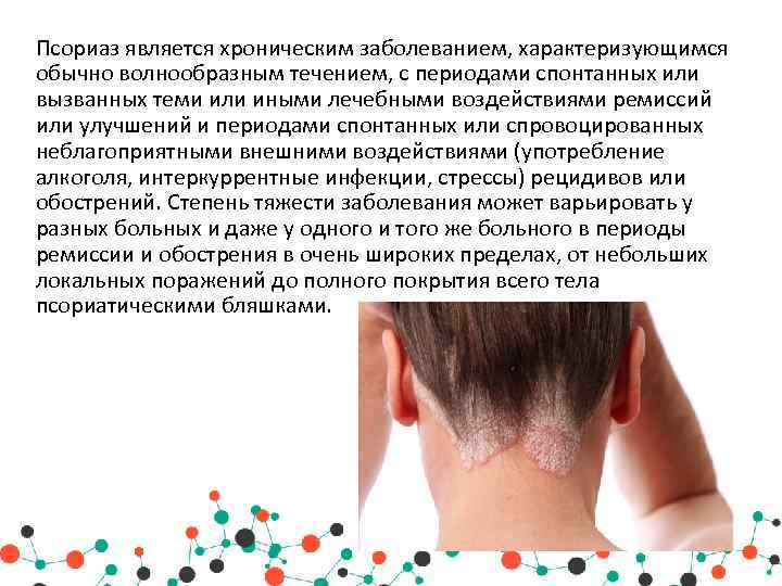 Псориаз является хроническим заболеванием, характеризующимся обычно волнообразным течением, с периодами спонтанных или вызванных теми