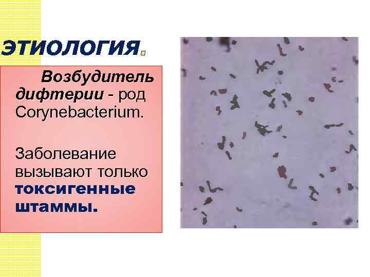 ЭТИОЛОГИЯ Возбудитель дифтерии - род Corynebacterium. Заболевание вызывают только токсигенные штаммы. 