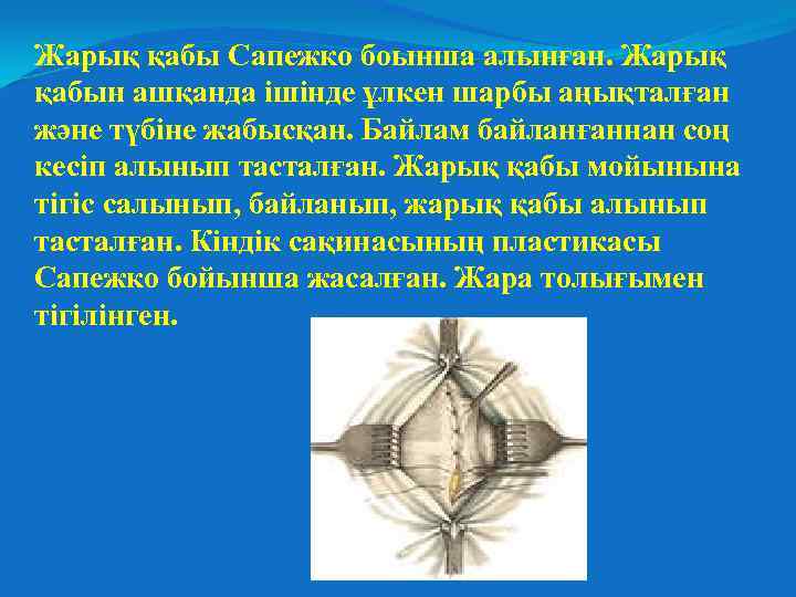 Жарық қабы Сапежко боынша алынған. Жарық қабын ашқанда ішінде ұлкен шарбы аңықталған және түбіне