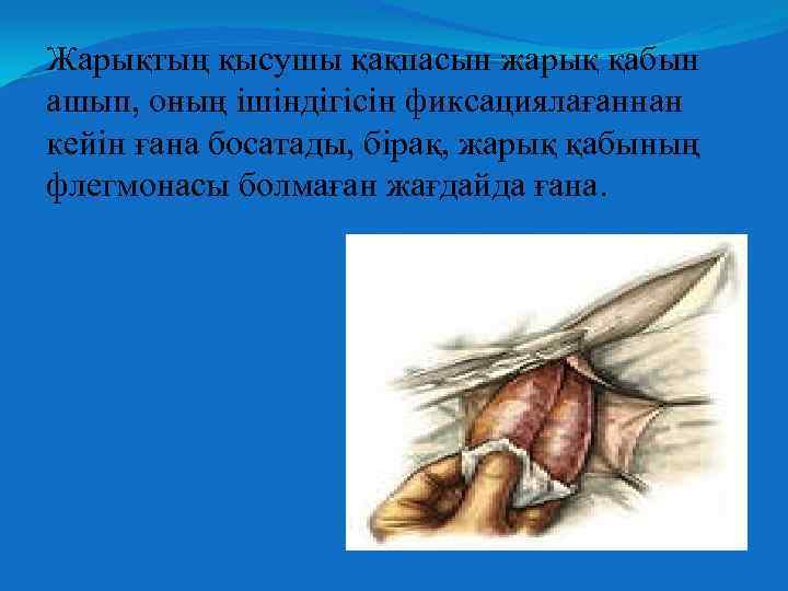 Жарықтың қысушы қақпасын жарық қабын ашып, оның ішіндігісін фиксациялағаннан кейін ғана босатады, бірақ, жарық
