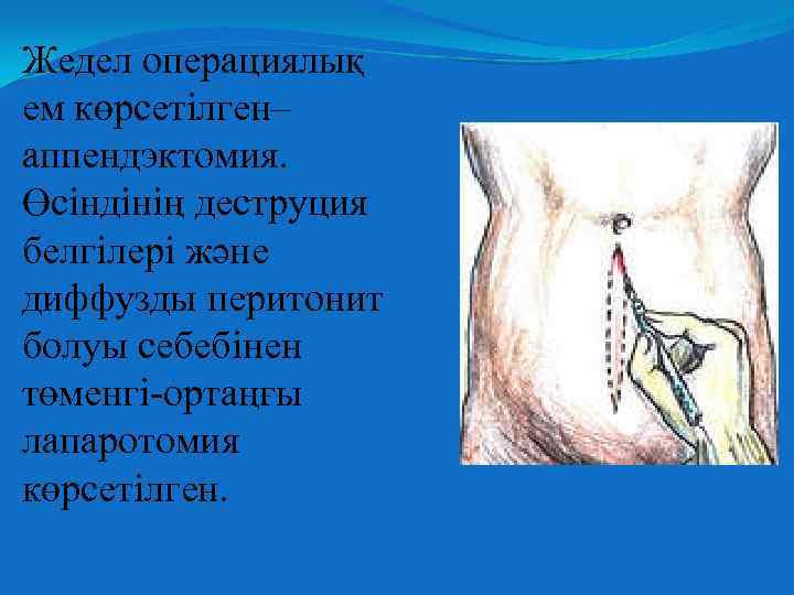 Жедел операциялық ем көрсетілген– аппендэктомия. Өсіндінің деструция белгілері және диффузды перитонит болуы себебінен төменгі-ортаңғы