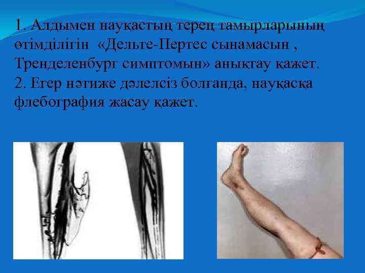 1. Алдымен науқастың терең тамырларының өтімділігін «Дельте-Пертес сынамасын , Тренделенбург симптомын» анықтау қажет. 2.