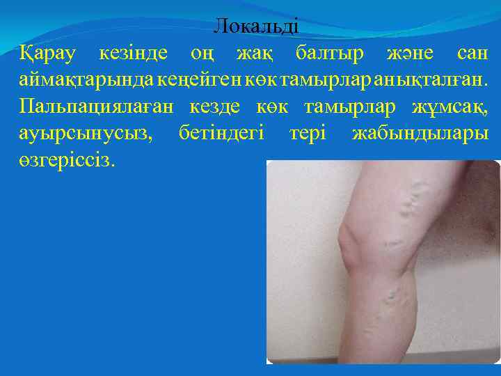 Локальді Қарау кезінде оң жақ балтыр және сан аймақтарында кеңейген көк тамырлар анықталған. Пальпациялаған