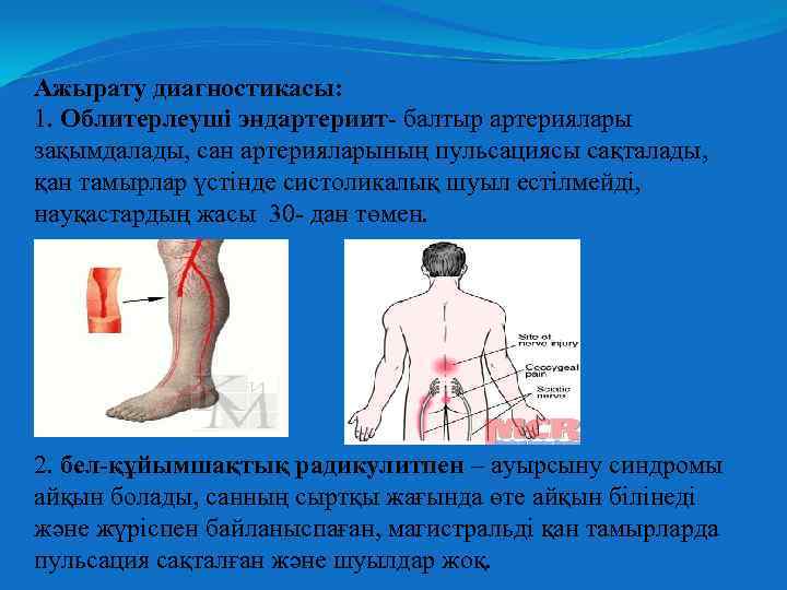 Ажырату диагностикасы: 1. Облитерлеуші эндартериит- балтыр артериялары зақымдалады, сан артерияларының пульсациясы сақталады, қан тамырлар