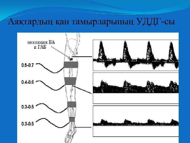 Аяқтардың қан тамырларының УДДГ-сы 