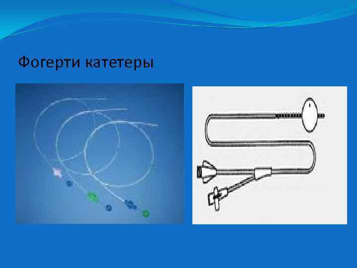 Фогерти катетеры 