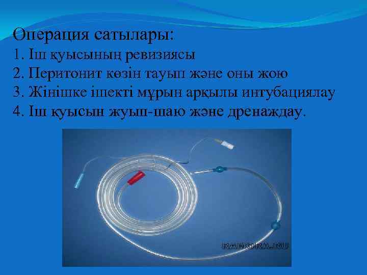 Операция сатылары: 1. Іш қуысының ревизиясы 2. Перитонит көзін тауып және оны жою 3.