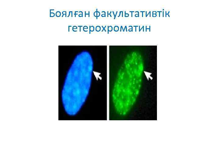 Боялған факультативтік гетерохроматин 