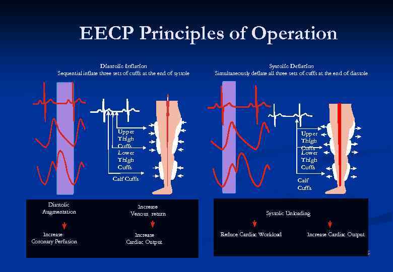 EECP Principles of Operation Diastolic Inflation Sequential inflate three sets of cuffs at the